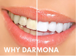 Why Darmona